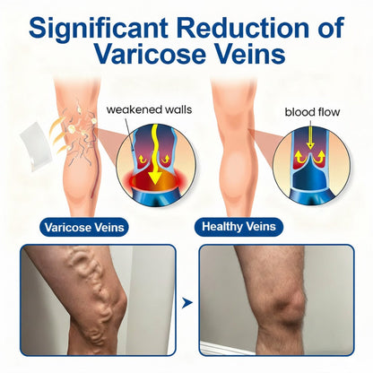 🇺🇸👨‍⚕️✅TAILEDEN® VeinEase Microneedle Care Patch⚡Instant Relief, Long-Term Results