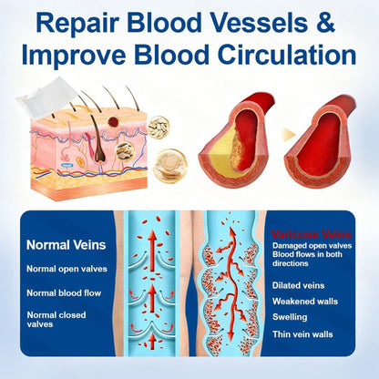 🇺🇸👨‍⚕️✅TAILEDEN® VeinEase Microneedle Care Patch⚡Instant Relief, Long-Term Results
