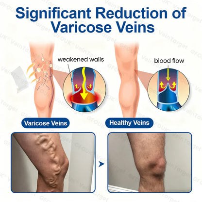 😻GFOUK® VeinTarget Microneedle Patch⚡Instant Relief, Long-Term Results