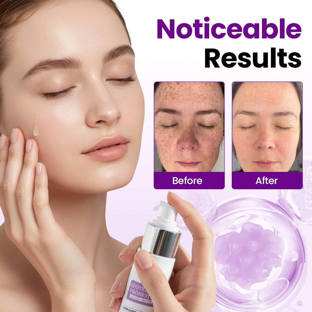 LOVILDS® SpotErase Probiotic Shield Serum
