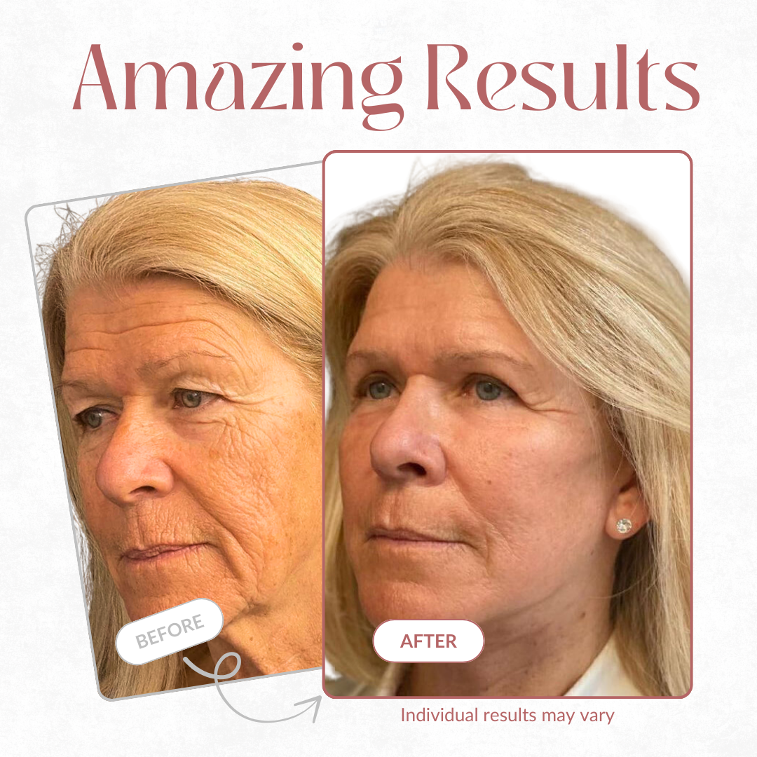 Cheemex Cemenrete Calcium Multi Balm