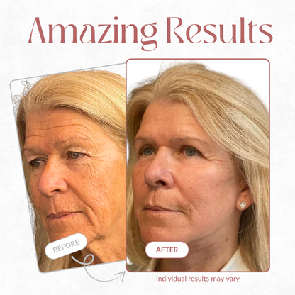 Cheemex Cemenrete Calcium Multi Balm