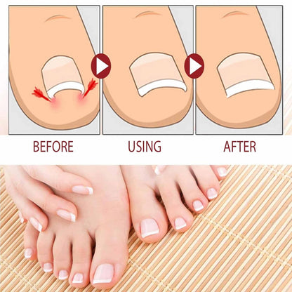 LOVILDS Natural Nail Fungus Treatment Gel - Fungus Cream, Multi-Purpose Nail Repair