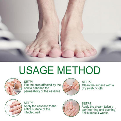 LOVILDS Natural Nail Fungus Treatment Gel - Fungus Cream, Multi-Purpose Nail Repair