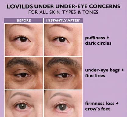 LOVILDS Eye Serum. Eliminate fatigue and revitalize your eyes!