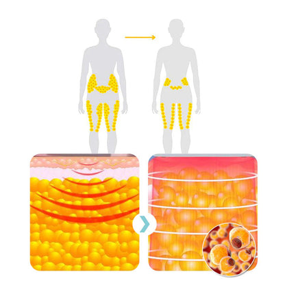 (🔥LAST DAY 70% OFF) Histone™ Matteo Ultrasonic Body Shape Wristband Pro 🔥