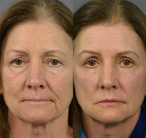 LOVILDS Eye Serum. Eliminate fatigue and revitalize your eyes!