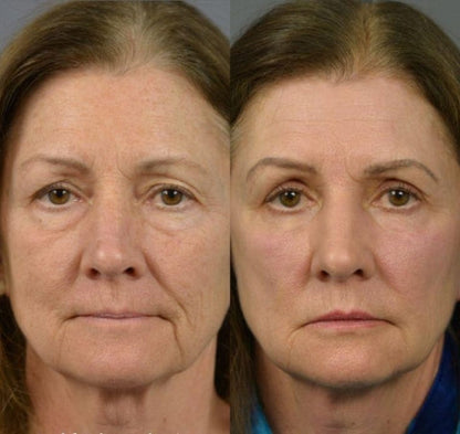 LOVILDS Eye Serum. Eliminate fatigue and revitalize your eyes!