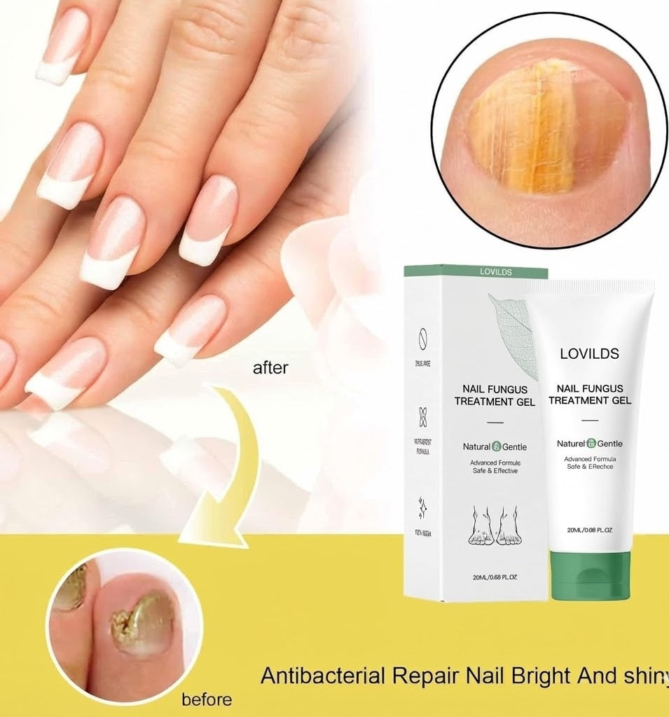 LOVILDS Natural Nail Fungus Treatment Gel - Fungus Cream, Multi-Purpose Nail Repair