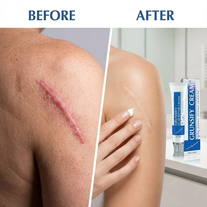 Grunsify Advanced Scar Repair Cream – Fade Scars & Tighten Skin for Men and Women